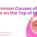 red spots on the top of mouth with small red spots on palate