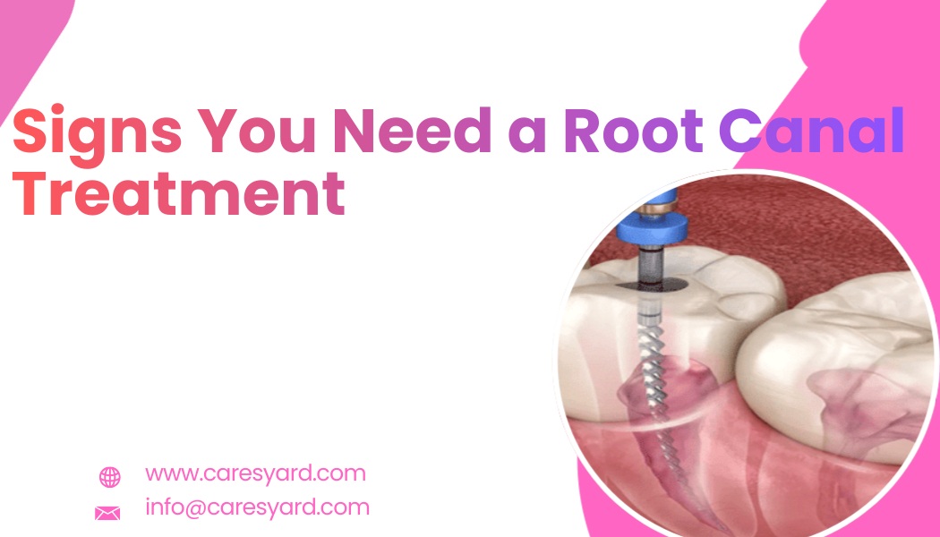 Signs you need a root canal treatment with tooth infection illustration