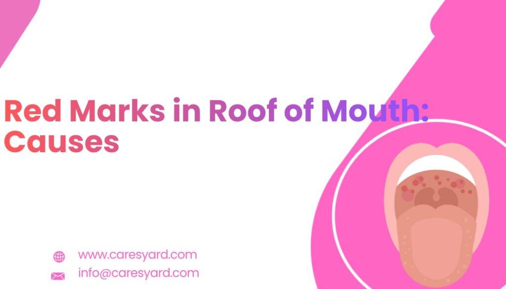 Close-up of red marks on the roof of the mouth