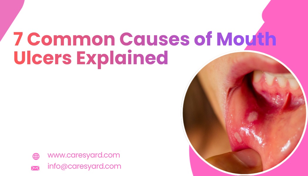common causes of mouth ulcers and mouth sore symptoms